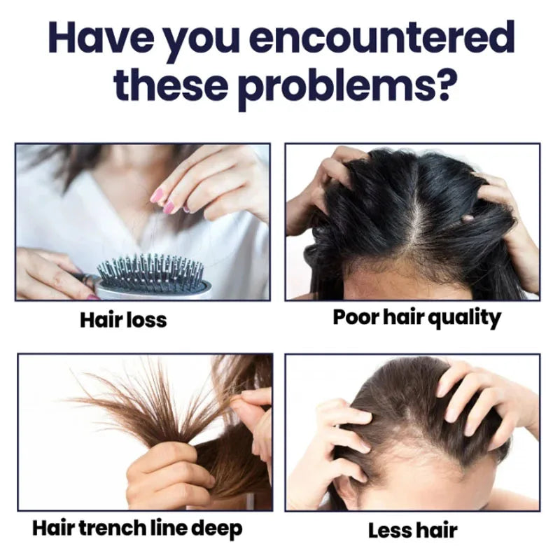 Natural Hair Regrowth Spray