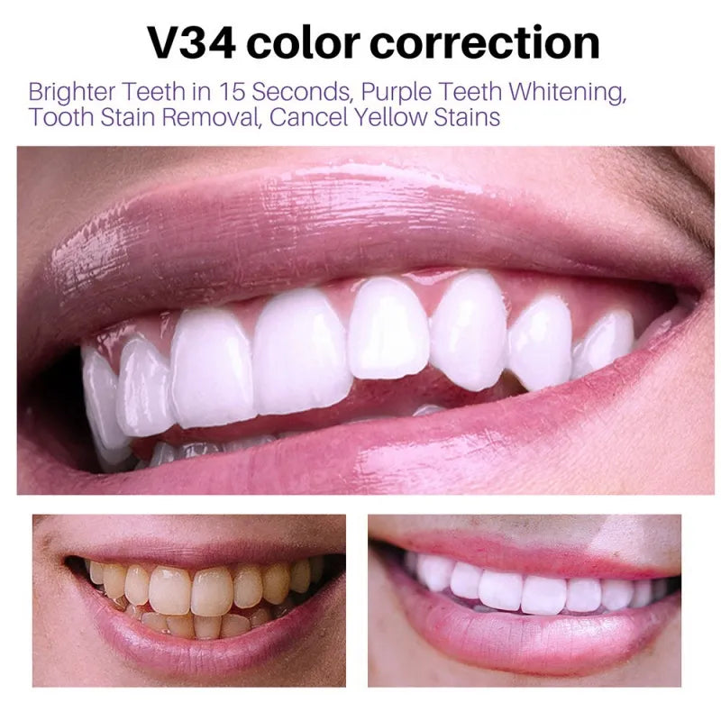 Teeth Colour Corrector Serum