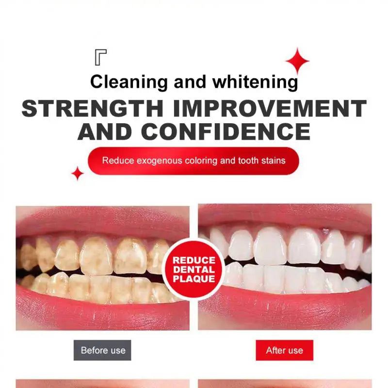 Intensive Teeth Whitening Toothpaste